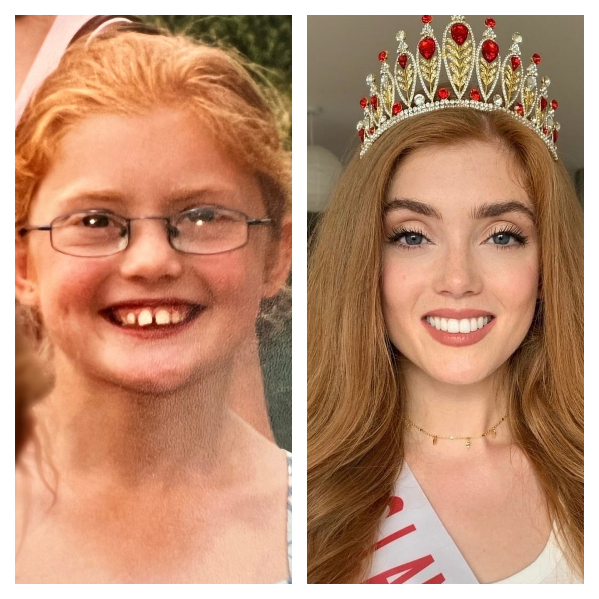 Beating the bullies for Redheads everywhere!