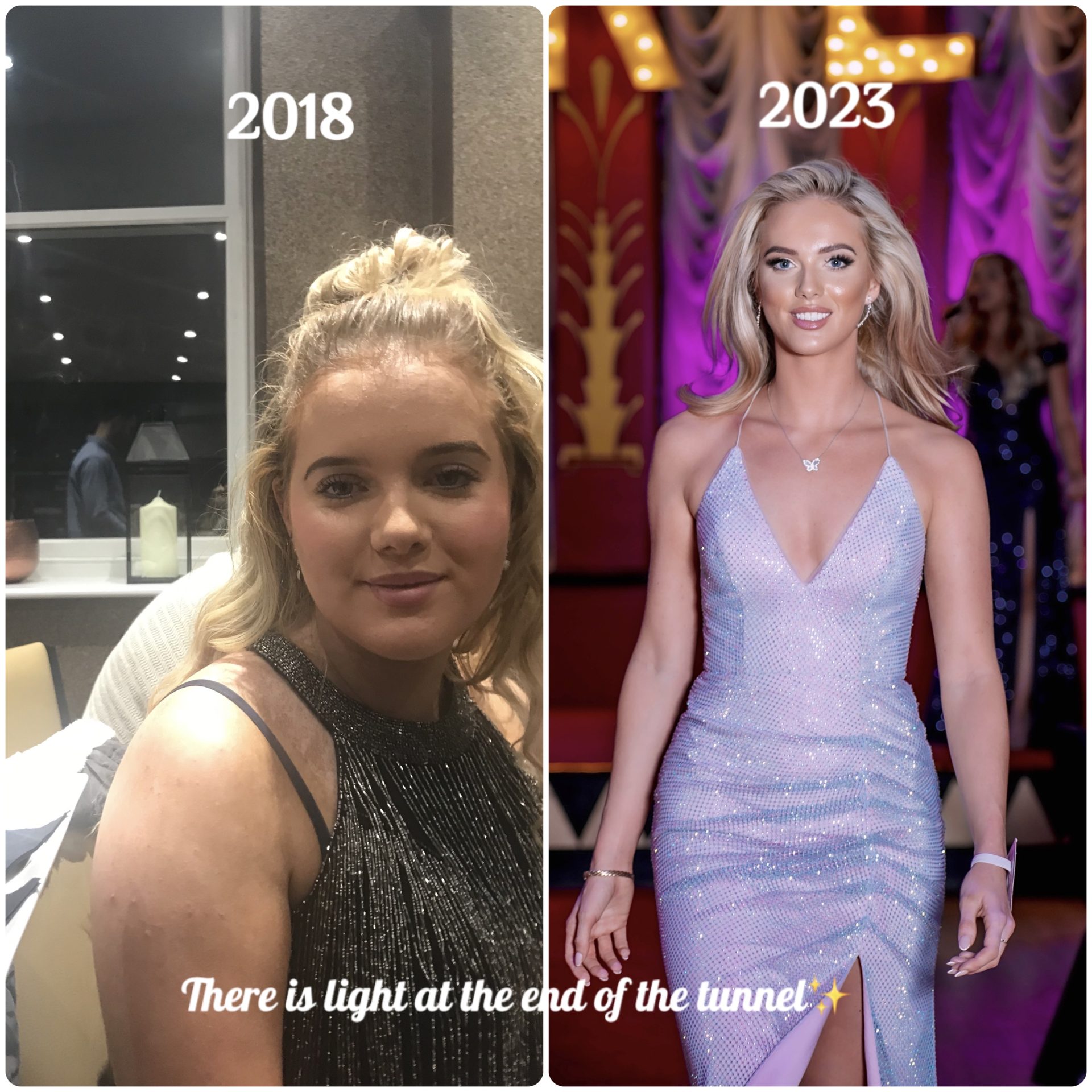 Miss England finalist Chloe McEwen shares her mental health journey – highlighting Mental Health week